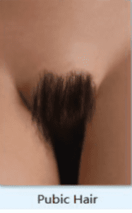 pubic hair